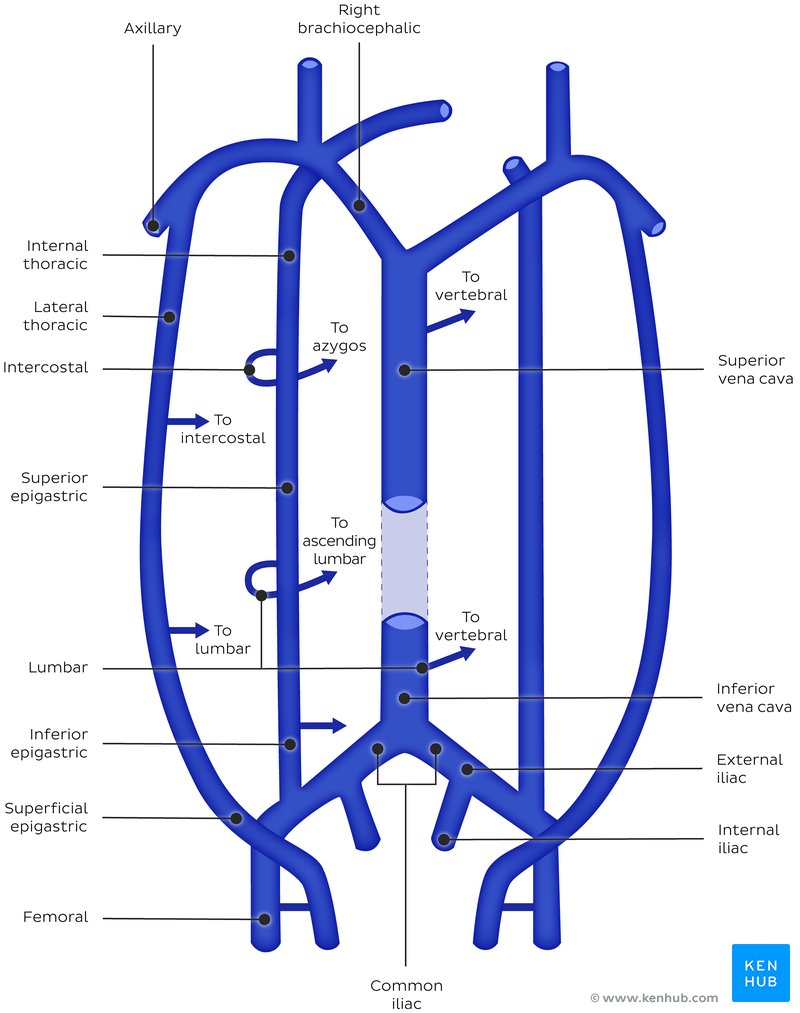 Collateral Venous Circulation via Superficial Abdominal Veins