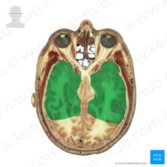 Lobo temporal (Lobus temporalis); Imagem: National Library of Medicine