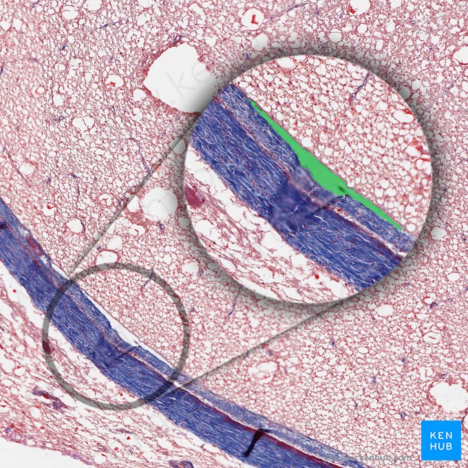 Subarachnoid space (Spatium subarachnoidale); Image: 