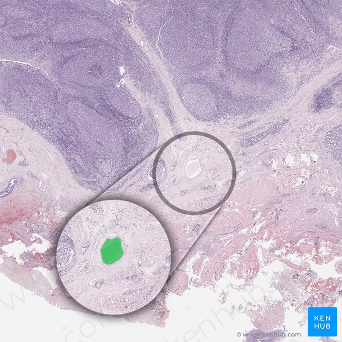 Efferent lymphatic vessel (Vas lymphaticum efferens); Image: 