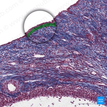 Tunica albuginea ovarii (Weißliche Gewebsschicht des Eierstocks); Bild: 