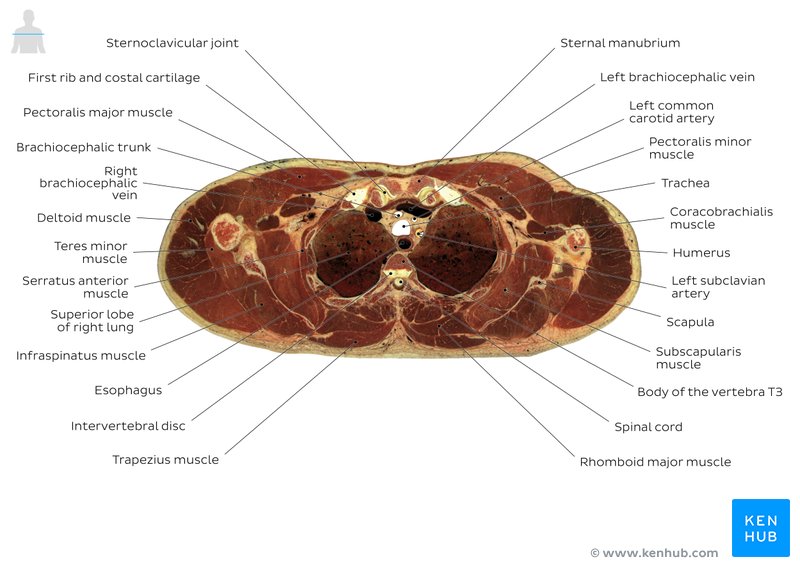 Cross section of the thorax through T3: Axial view