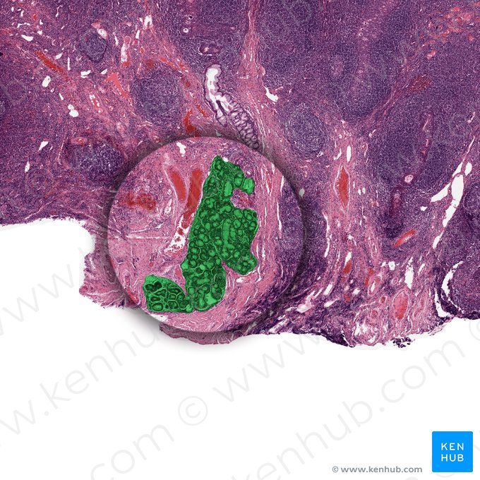 Glándula salival seromucosa; Imagen: 