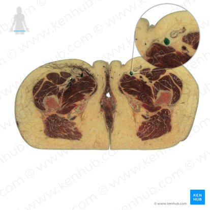 Veia safena magna (Vena saphena magna); Imagem: National Library of Medicine