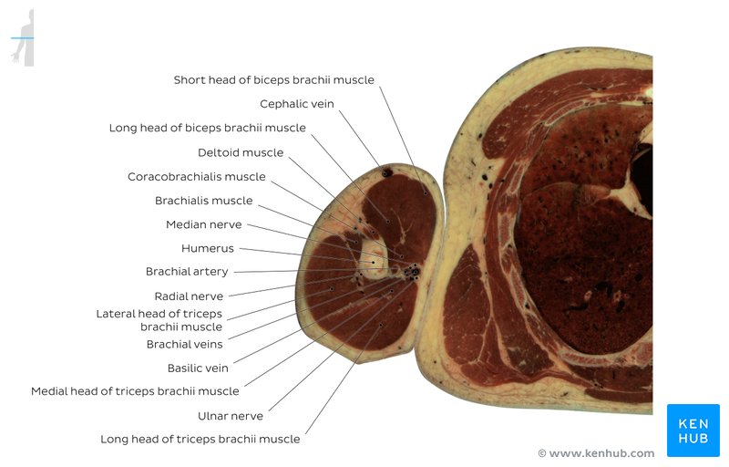 Arm cross section through the biceps brachii muscle: Axial view