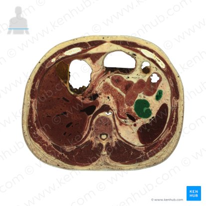 Descending colon (Colon descendens); Image: National Library of Medicine