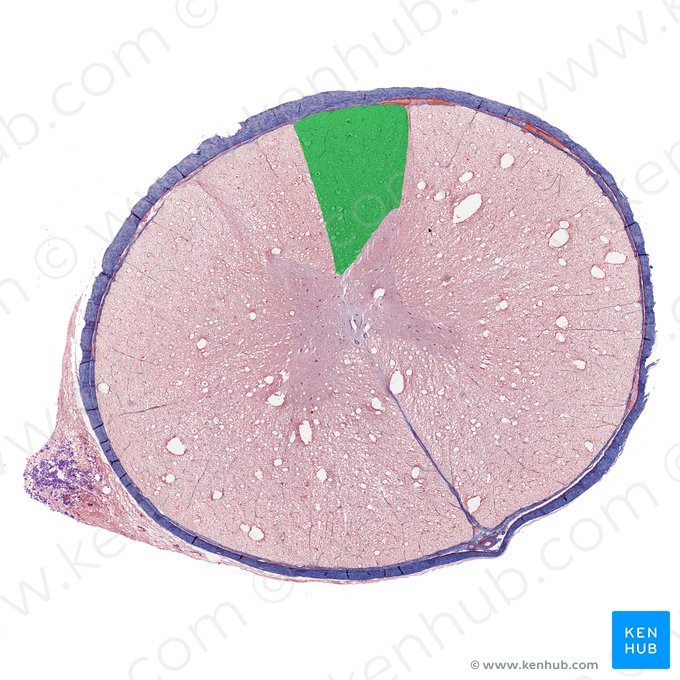 Cordón posterior de la medula espinal (Funiculus posterior medullae spinalis); Imagen: 