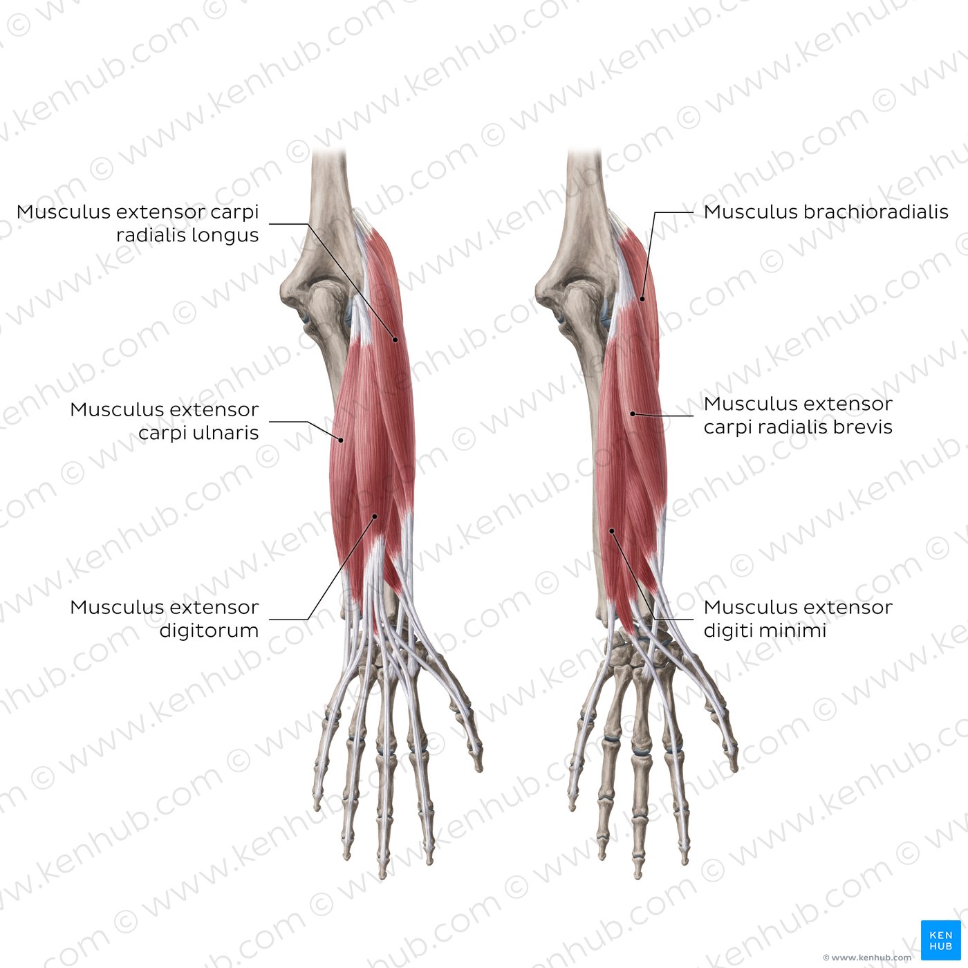 Extensoren des Unterarms