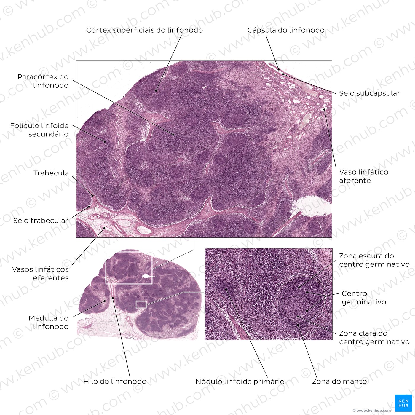 Active lymph node. Stain: hematoxylin and eosin. Medium magnification.