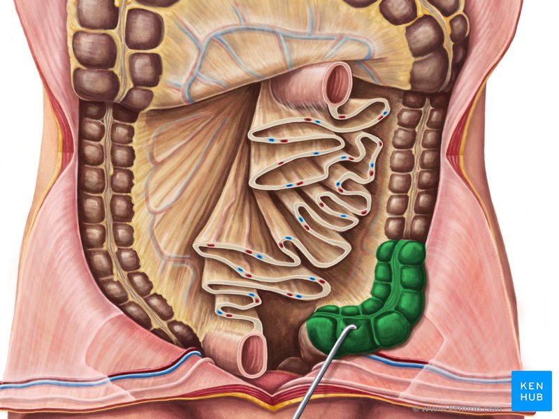 sigmoid colon in situ ventral view