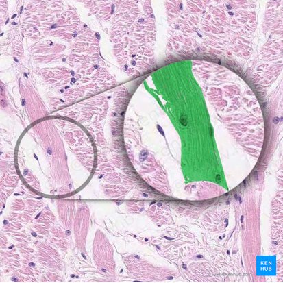 Myocyte (muscle fiber) (Myocytus (Myofibra)); Image: 