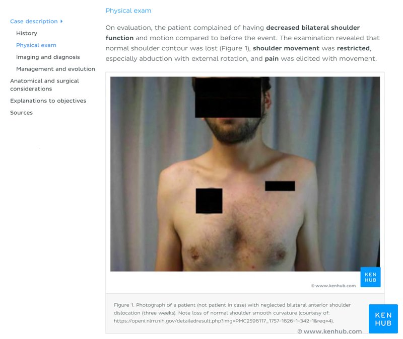 Screenshot of a Kenhub article showing clinical correlations embedded in the anatomical text.