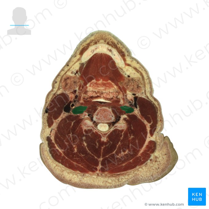 Musculus longus capitis (Langer Kopfmuskel); Bild: National Library of Medicine