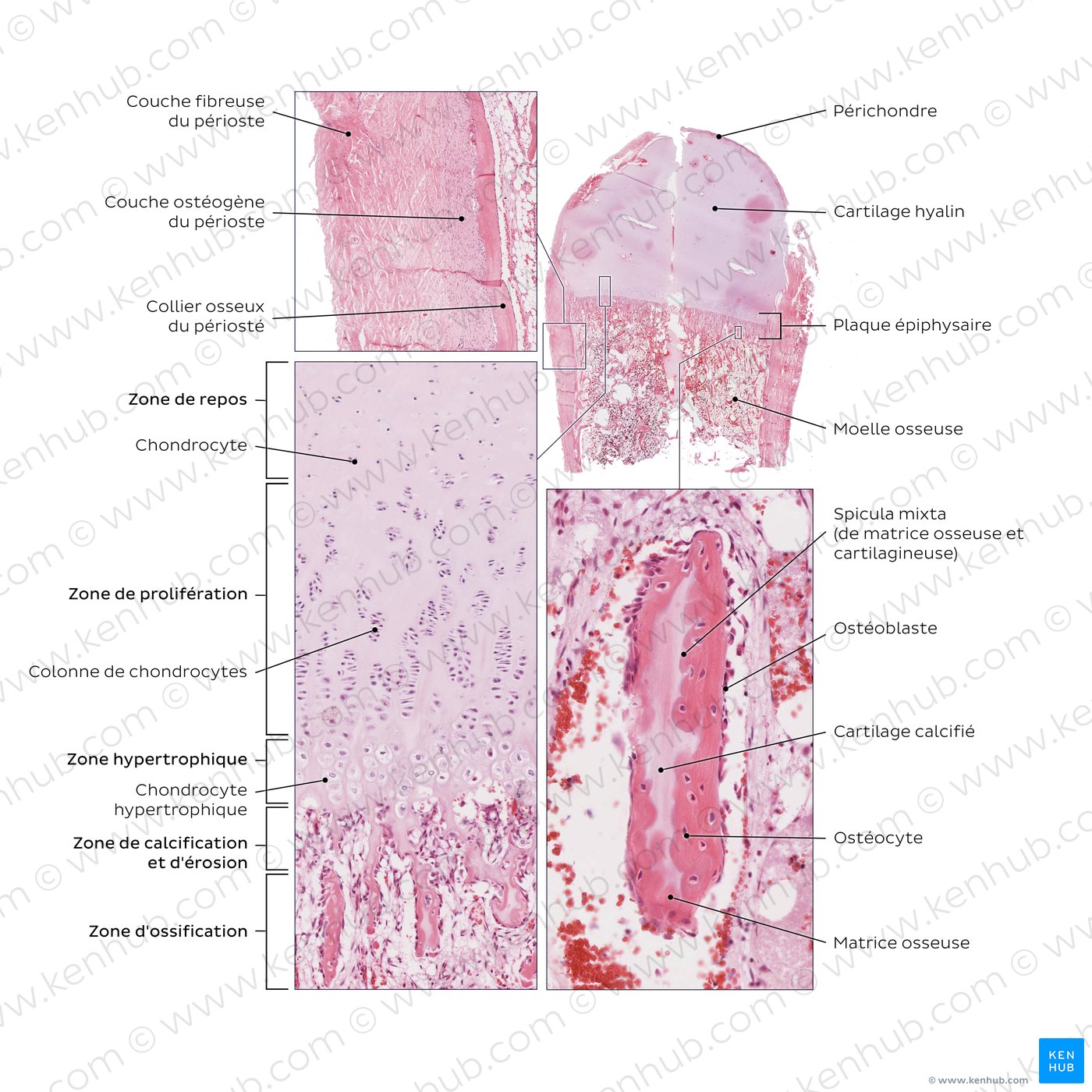Endochondral and periosteal ossification. Stain: H&E.