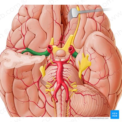 Arteria cerebral media (Arteria media cerebri); Imagen: Paul Kim