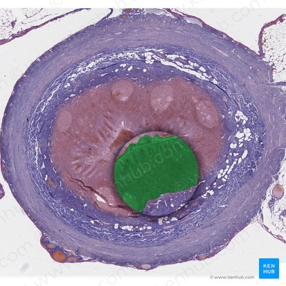 Mucosa (Tunica mucosa); Imagen: 