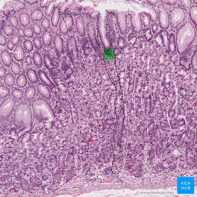 Isthme de la glande gastrique (Isthmus glandulae gastricae); Image : 
