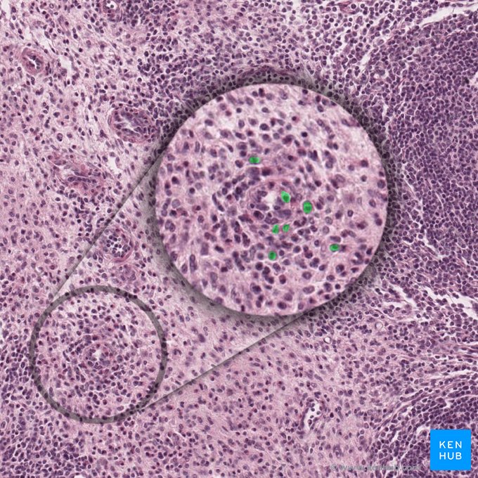 Células plasmáticas (Plasmocytus); Imagen: 