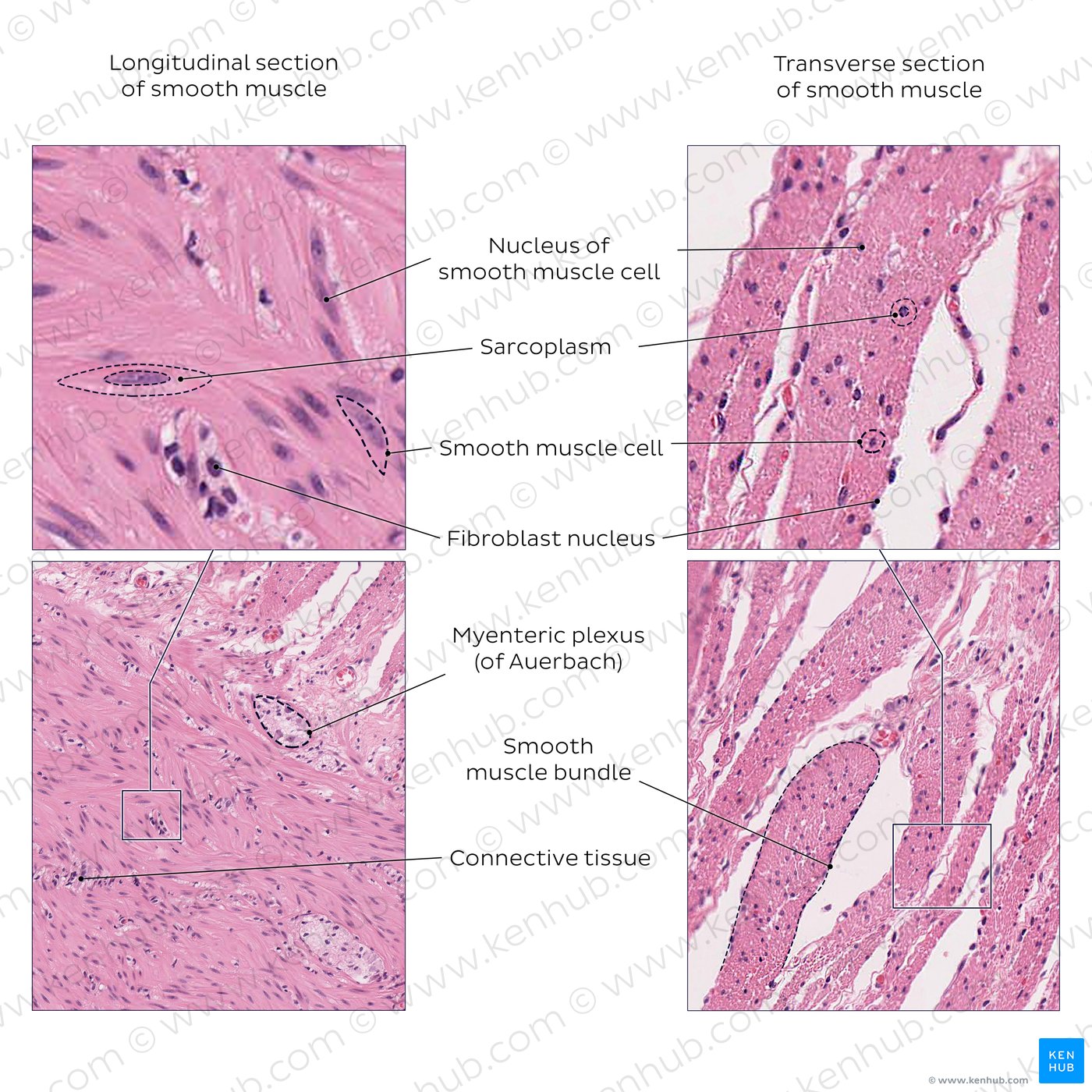 Smooth Muscle Longitudinal Section
