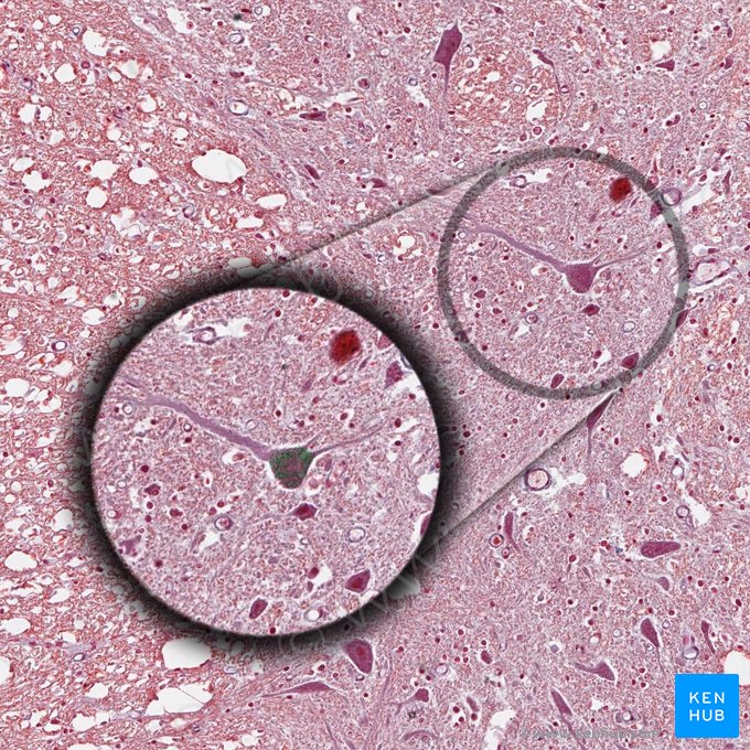 Chromatophilic substance (Nissl bodies) (Substantia chromatophilica); Image: 