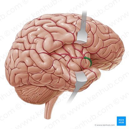 Artère cérébrale moyenne (Arteria media cerebri); Image : Paul Kim