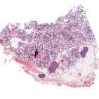 Salivary glands