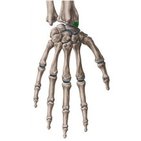 Processus styloideus radii