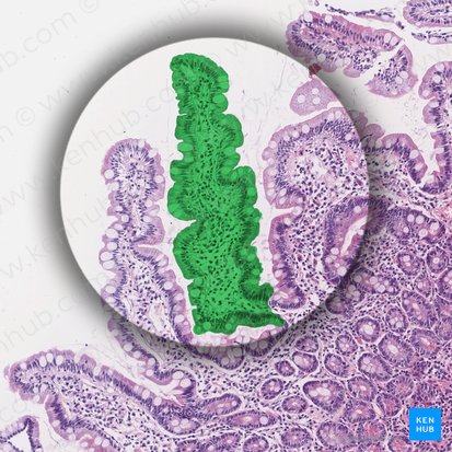 Vilosidade intestinal (Villus intestinalis); Imagem: 