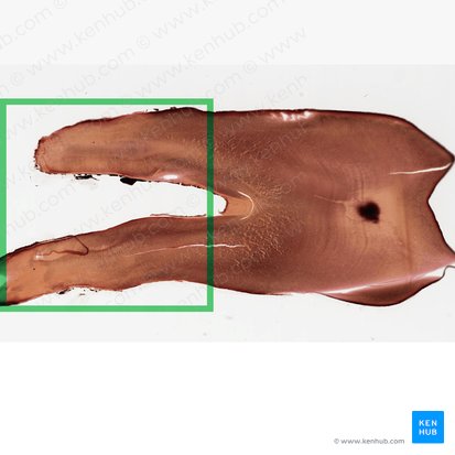 Radix dentis (Zahnwurzel); Bild: 