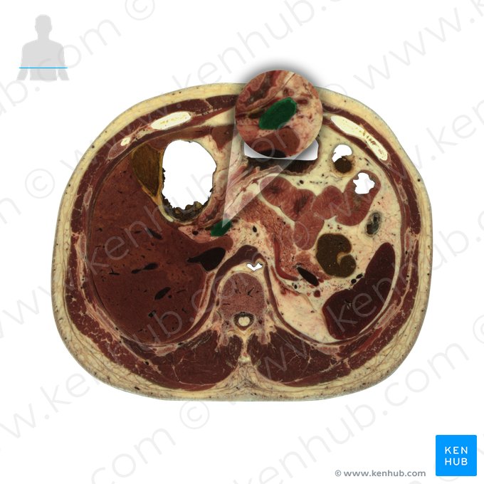 Hepatic portal vein (Vena portae hepatis); Image: National Library of Medicine