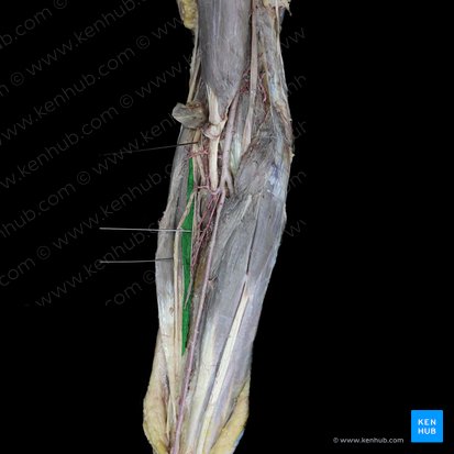 Musculus extensor carpi radialis brevis (Kurzer speichenseitiger Handstrecker); Bild: 
