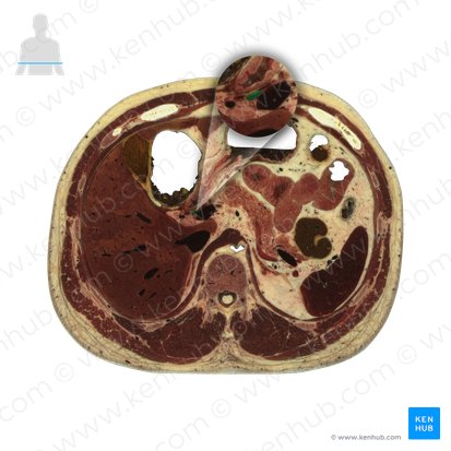 Conducto colédoco (Ductus biliaris); Imagen: National Library of Medicine