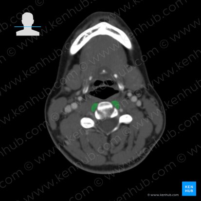 Longus colli muscle (Musculus longus colli); Image: 