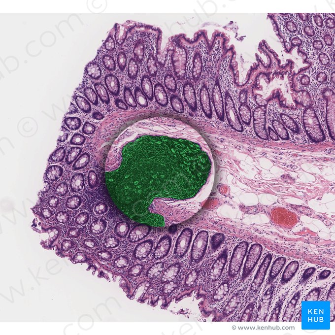 Ganglio linfático (Nodulus lymphoideus); Imagen: 