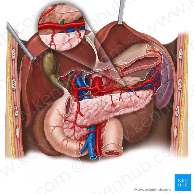 Arteria gastrica posterior (Hintere Magenarterie); Bild: Esther Gollan