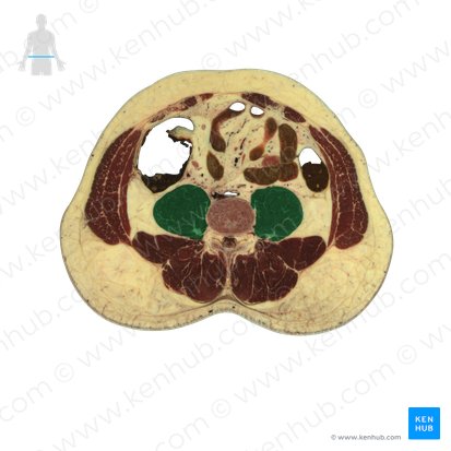 Musculus psoas major (Großer Lendenmuskel); Bild: National Library of Medicine