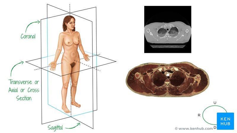 Importance of cross-sectional anatomy