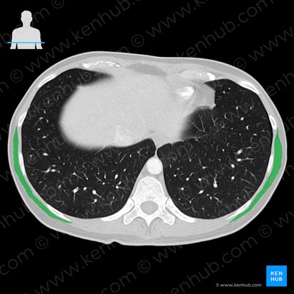 Músculo latíssimo do dorso (Musculus latissimus dorsi); Imagem: 