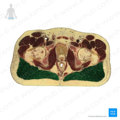 Musculus gluteus maximus (Großer Gesäßmuskel); Bild: National Library of Medicine