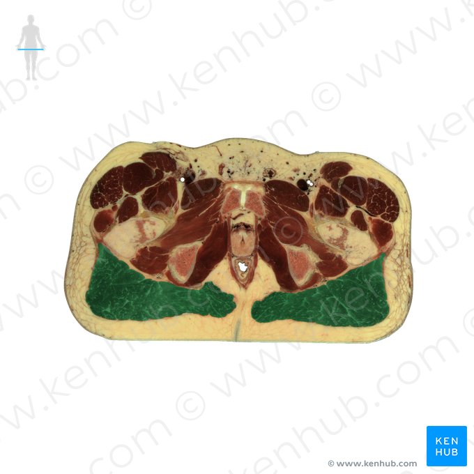 Músculo glúteo máximo (Musculus gluteus maximus); Imagem: National Library of Medicine