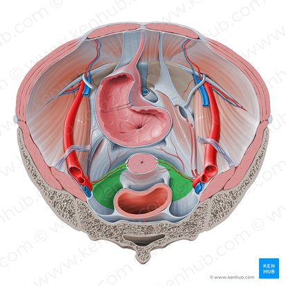 Ligamento cardinal (Ligamentum cardinale); Imagen: Paul Kim