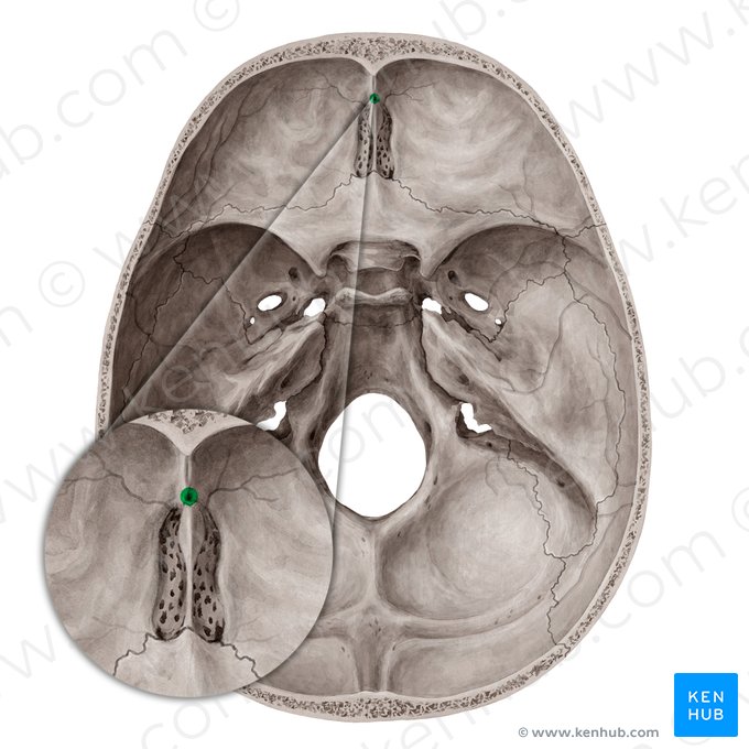 Forame cego do osso frontal (Foramen caecum ossis frontalis); Imagem: Yousun Koh