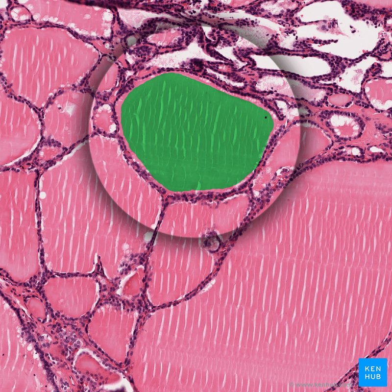 Colloid - histological slide