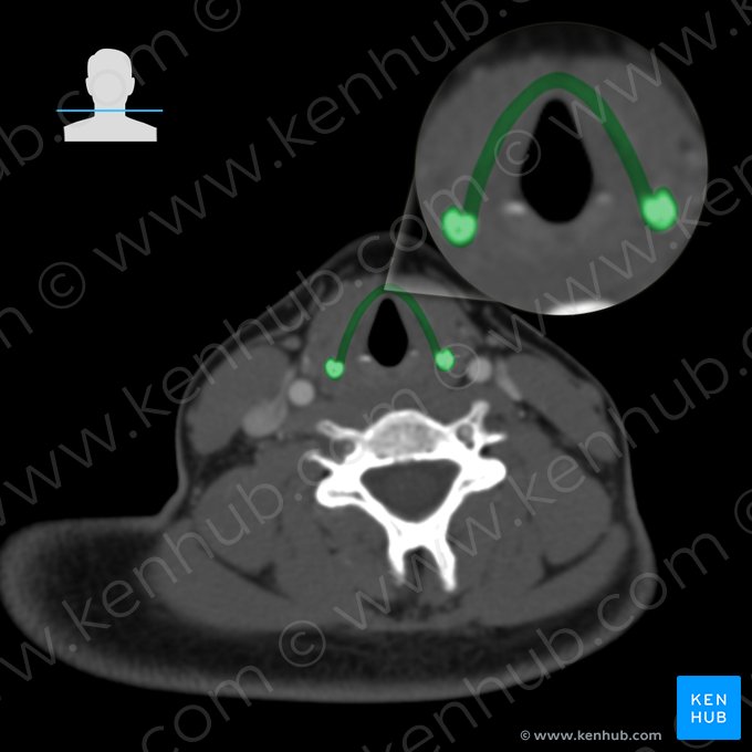 Cartílago tiroides (Cartilago thyroidea); Imagen: 