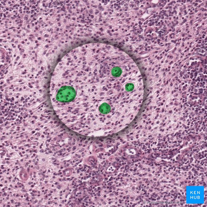 High endothelial venule (Venula altoendothelialis); Image: 