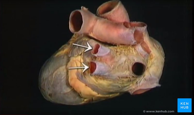 Acland's Video Atlas of Human Anatomy - Highlights & Labels