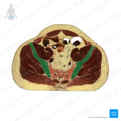 Ilion (Os ilium); Imagen: National Library of Medicine