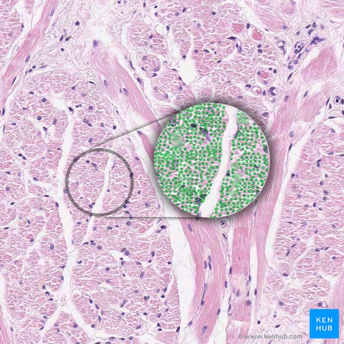 Myofibril (Myofibrilla); Image: 