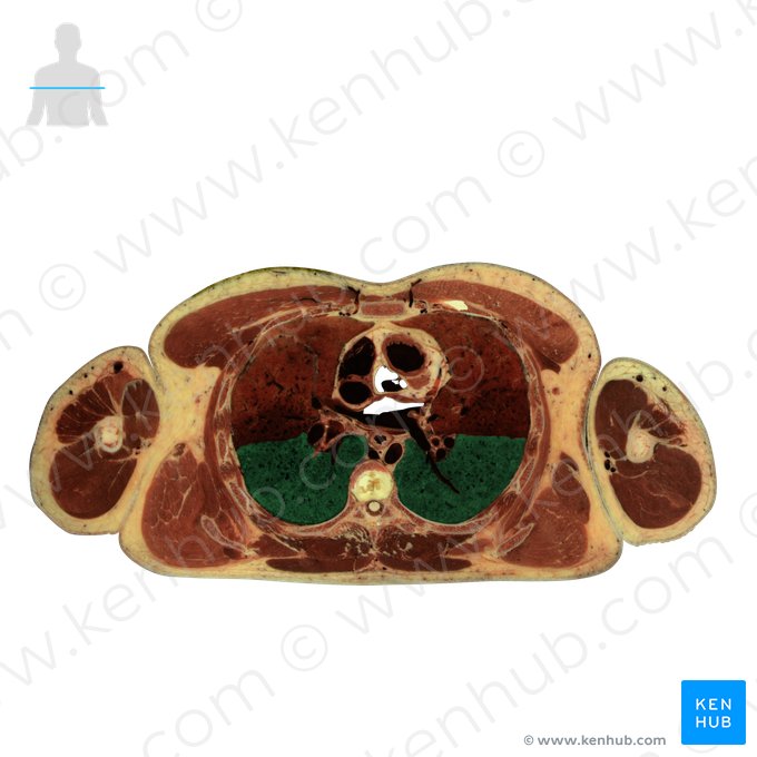 Lobo inferior do pulmão (Lobus inferior pulmonis); Imagem: National Library of Medicine