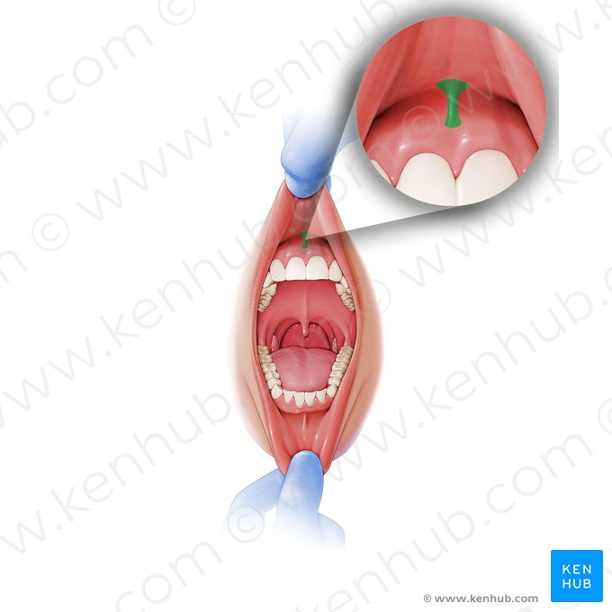 Frênulo do lábio superior (Frenulum labii superioris); Imagem: Paul Kim